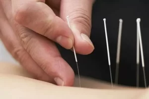 Cara Sederhana Menjaga Kesehatan dengan Pengobatan Tradisional